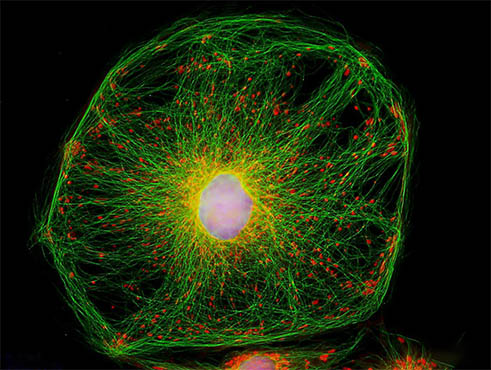 显微镜下的细胞骨架.jpg 显微镜下的细胞骨架.jpg