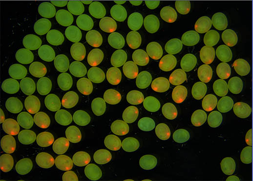 显微镜下的虫卵筛查.jpg 显微镜下的虫卵筛查.jpg