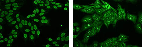 自身免疫.jpg 自身免疫.jpg