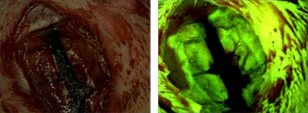 活器官.jpg 活器官.jpg