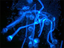 结核.jpg 结核.jpg