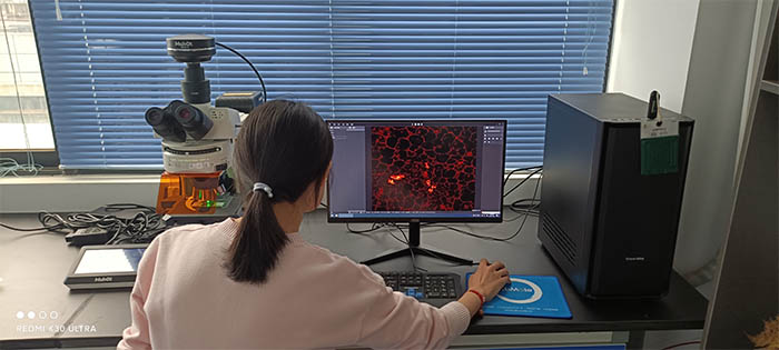 荧光显微镜下的免疫荧光.jpg 荧光显微镜下的免疫荧光.jpg