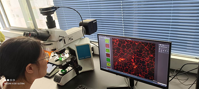 荧光显微镜下的免疫荧光1.jpg 荧光显微镜下的免疫荧光1.jpg