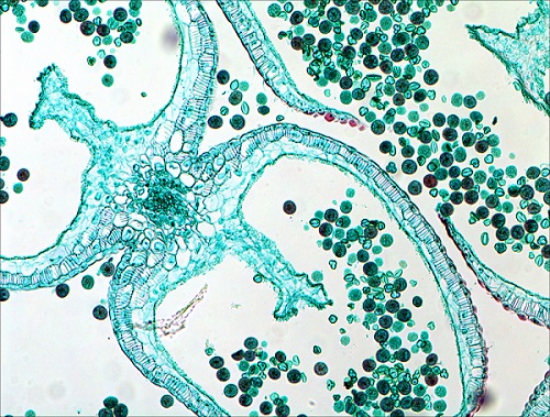 植物学04_10X罂粟花芽a.JPG 植物学04_10X罂粟花芽a.JPG