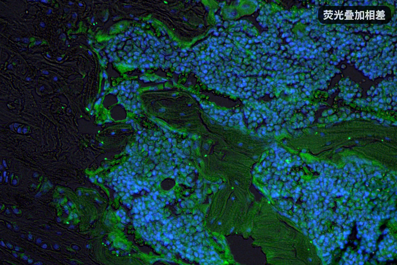 相衬_07.png 相衬_07.png