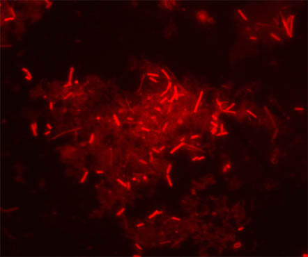 荧光显微镜MF43-N1.jpg 荧光显微镜MF43-N1.jpg