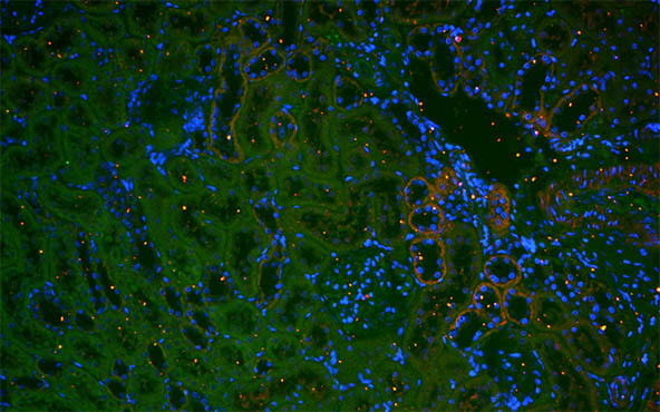 正置荧光显微镜MF43-N1.jpg 正置荧光显微镜MF43-N1.jpg