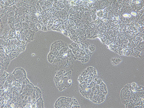 细胞治疗1.jpg 细胞治疗1.jpg