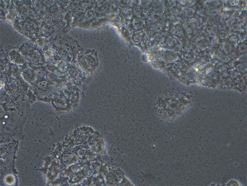 细胞治疗2.jpg 细胞治疗2.jpg