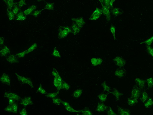 倒置荧光显微镜MF52-N_3.jpg 倒置荧光显微镜MF52-N_3.jpg