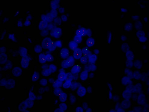 FISH荧光显微镜MF43-N_3.jpg FISH荧光显微镜MF43-N_3.jpg