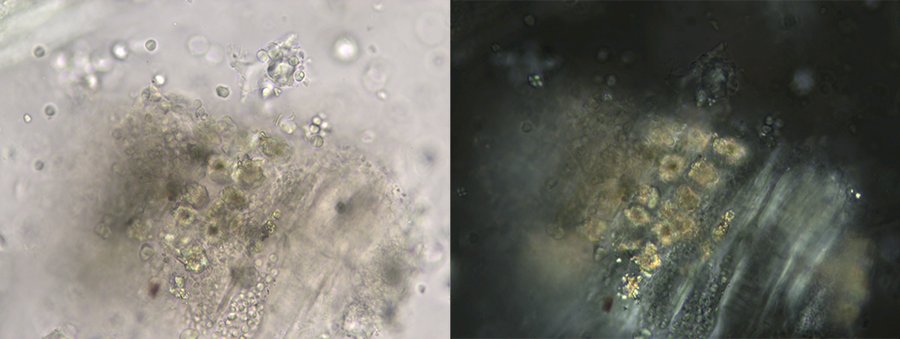 05TCM_7-2a牡丹皮-草酸钙簇晶.jpg 05TCM_7-2a牡丹皮-草酸钙簇晶.jpg