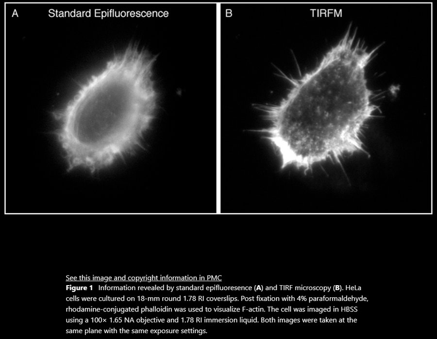 03TIRF_TIRF.jpg 03TIRF_TIRF.jpg