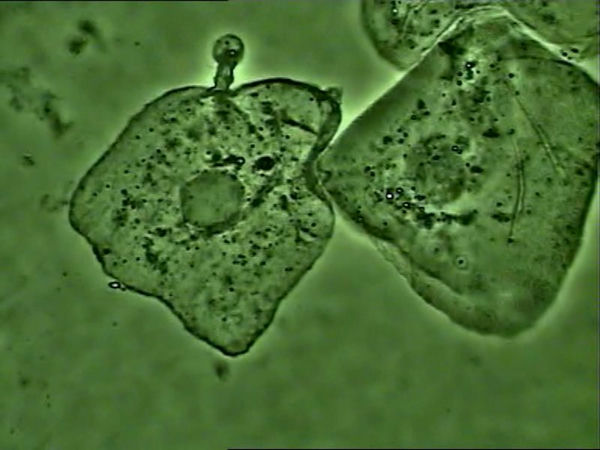 04_相衬支原体.jpg 04_相衬支原体.jpg