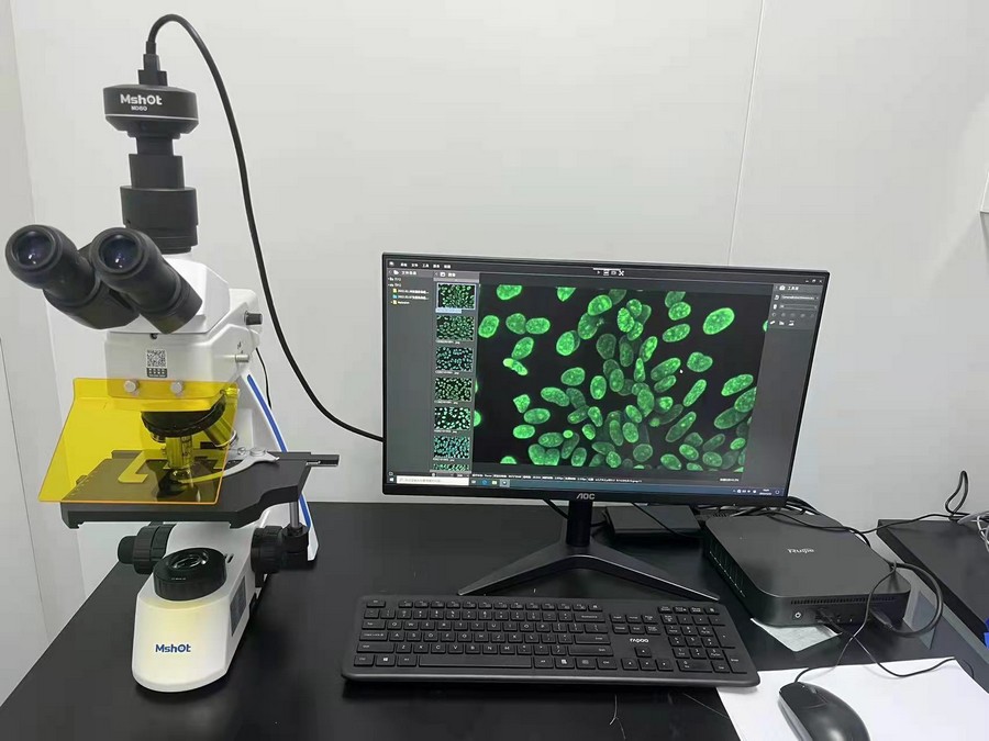 07_篮状菌.jpg 07_篮状菌.jpg