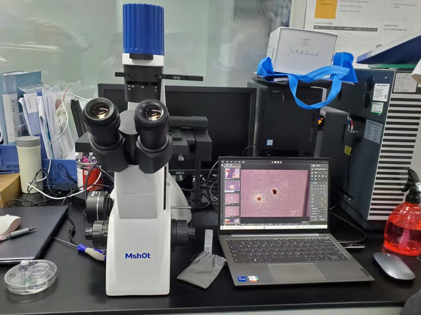 人造血祖细胞_MI52-N+MDX10_202208_造血祖细胞形成集落鉴定_7.png 人造血祖细胞_MI52-N+MDX10_202208_造血祖细胞形成集落鉴定_7.png