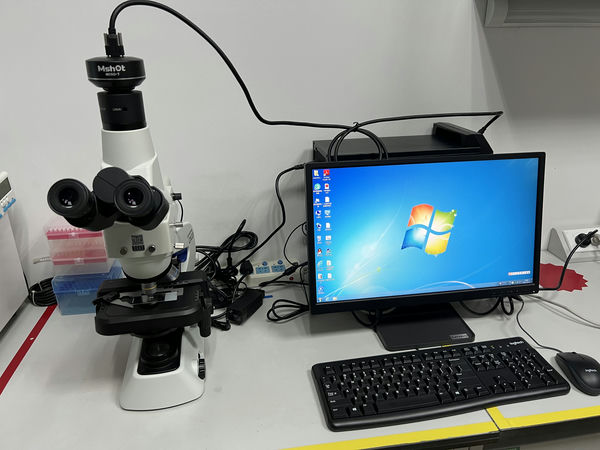 皮肤真菌皮屑_MF23-M+MD50-T_202310_北京中医药大学深圳医院(龙岗)皮肤科(快速检查真菌感染)_3.jpg 皮肤真菌皮屑_MF23-M+MD50-T_202310_北京中医药大学深圳医院(龙岗)皮肤科(快速检查真菌感染)_3.jpg