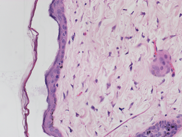 HE染色病理切片_ ML31+MS60_202311_ 清晰观察和拍摄病理切片_3.png