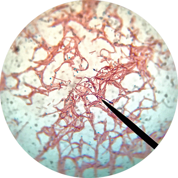 Bacillus_subtilis_endospore_stain.png