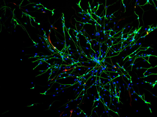 荧光观察07.jpg 荧光观察07.jpg