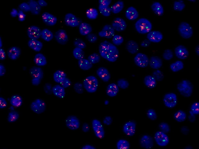 荧光观察09.jpg 荧光观察09.jpg