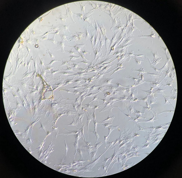 01DIC_DIC细胞.jpg 01DIC_DIC细胞.jpg