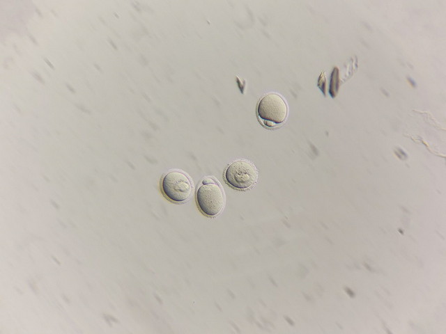 01HMC_MF53-PMC卵母细胞_cr.jpg 01HMC_MF53-PMC卵母细胞_cr.jpg