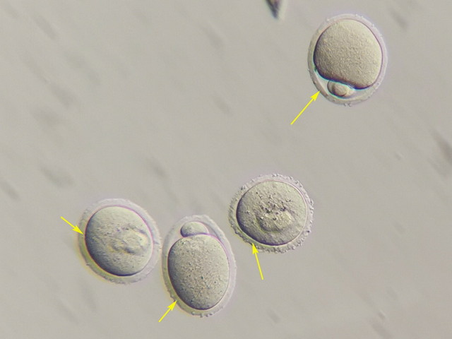 14HMC_成像效果差异.jpg 14HMC_成像效果差异.jpg