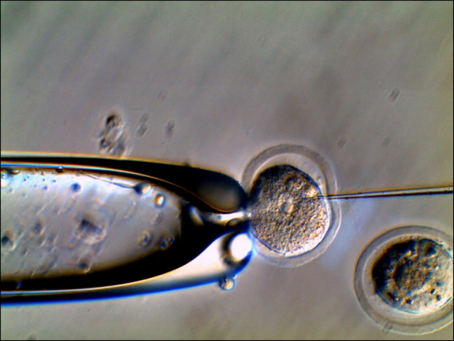 15HMC_显微注射.jpg 15HMC_显微注射.jpg