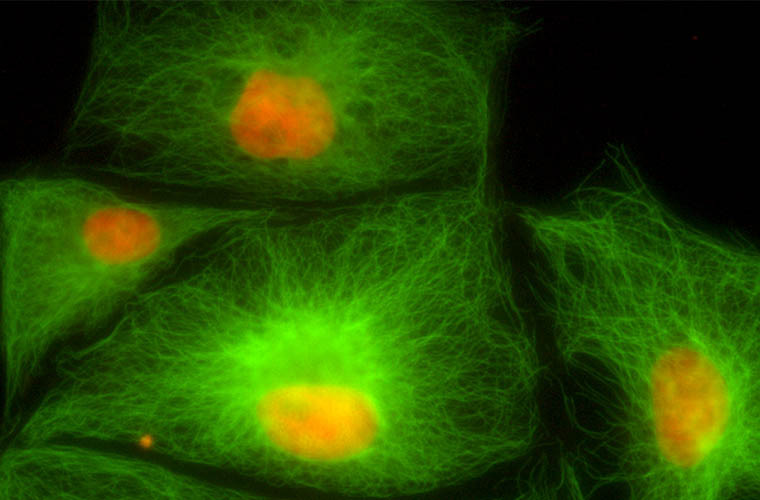 科学家培育转基因荧光兔子 注入水母DNA