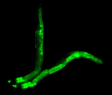 明美倒置荧光显微镜用于神经细胞的观察