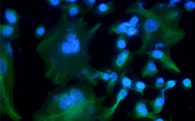 上了“色”的细胞，用什么显微镜来观察？