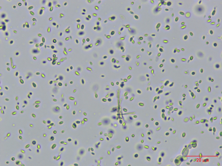 生物显微镜下的酵母菌观察