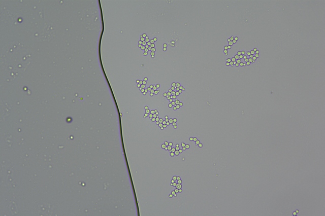 正置荧光显微镜MF31应用于酵母菌观察