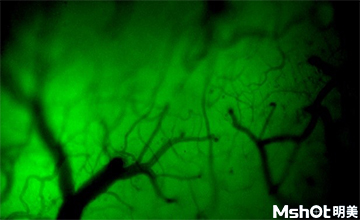 明美荧光显微镜应用于中国医科大学作活体小鼠染色观察