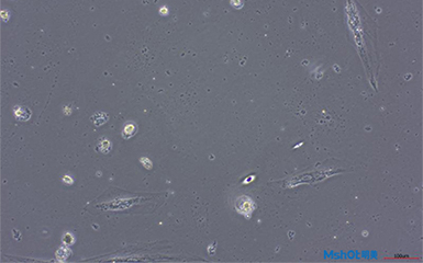 倒置显微镜应用于深圳某诊所活细胞观察