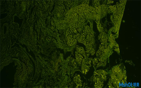 倒置荧光显微镜应用于北京大学深圳医院口腔上皮细胞观察4.jpg