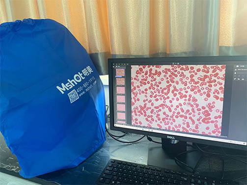 明美倒置显微镜用于看血细胞切片.jpg