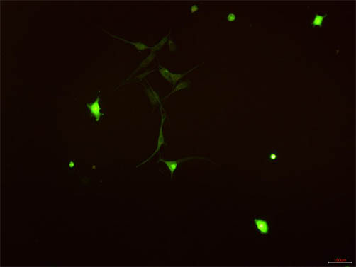 明美倒置荧光显微镜助力活体细胞培养