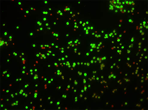 明美荧光显微镜在妇科真菌感染方面的应用
