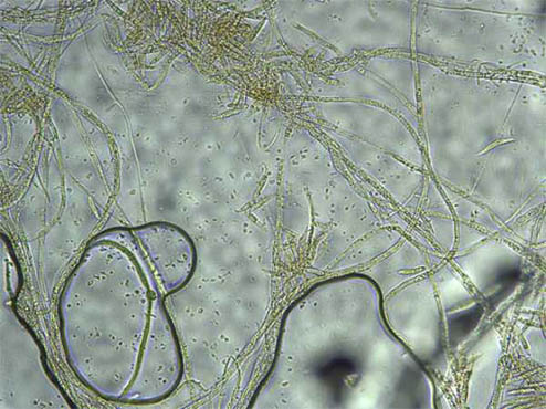 显微镜下的毛霉菌图片图片