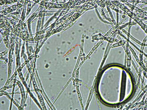 细菌、霉菌傻傻分不清楚怎么办？——显微镜来鉴别