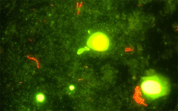 真菌检测新时代——真菌荧光显微镜检测