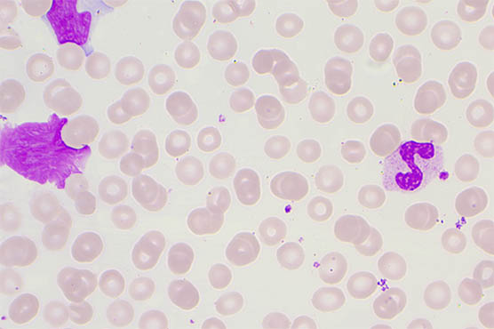 荧光显微镜用于血液样品观察与分析