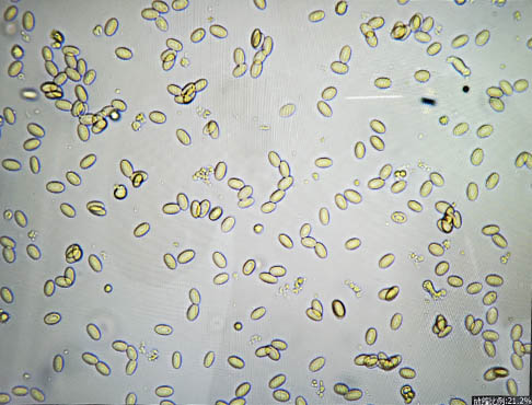 显微镜下的血细胞.jpg