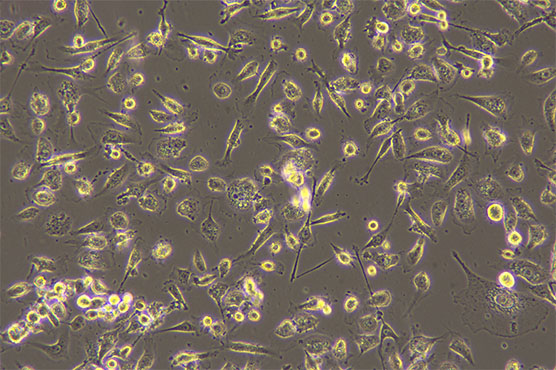 倒置显微镜下的活体细胞2.jpg