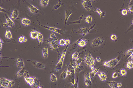 倒置显微镜下的活体细胞1.jpg