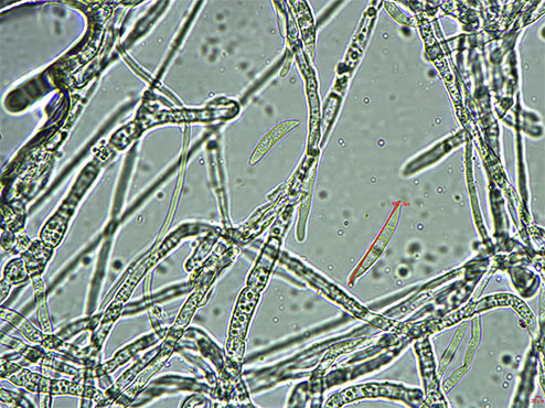 生物显微镜下的真菌菌丝1.jpg