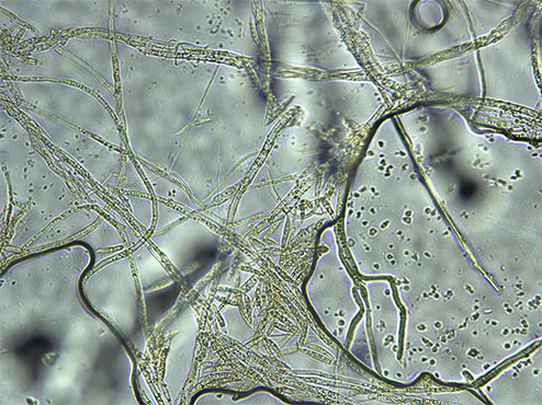 生物显微镜下的真菌菌丝2.jpg