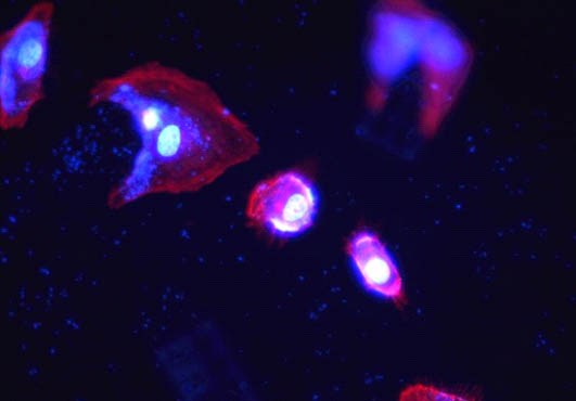 活细胞成像用什么显微镜好？